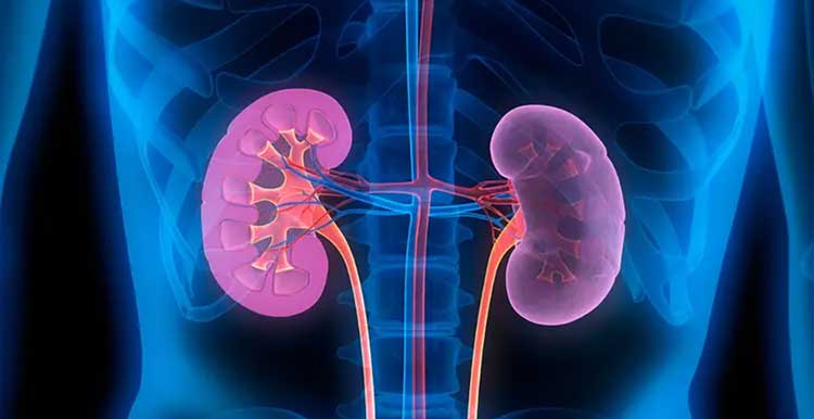 نارسایی کلیوی